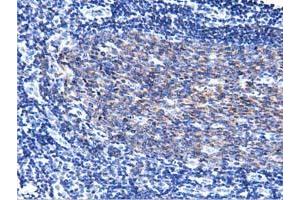 Immunohistochemical staining of paraffin-embedded Human lymph node tissue using anti-PIK3AP1 mouse monoclonal antibody. (PIK3AP1 anticorps)