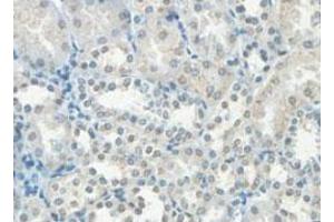Immunohistochemical analysis of paraffin-embedded human fetal kidney showing cytoplasmic staining with HHLA3 polyclonal antibody  at a 1 : 100 dilution. (HHLA3 anticorps  (AA 1-122))