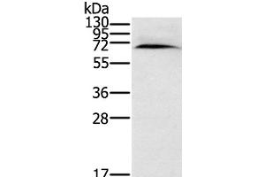 Western Blot analysis of Human normal kidney tissue using CYP11A1 Polyclonal Antibody at dilution of 1:200 (CYP11A1 anticorps)