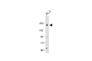 Anti-JLP (SG9) Antibody (N-term) at 1:2000 dilution + PC-3 whole cell lysate Lysates/proteins at 20 μg per lane. (SPAG9 anticorps  (N-Term))