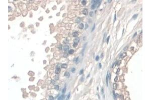 Detection of COQ6 in Human Prostate Tissue using Polyclonal Antibody to Coenzyme Q6 Homolog, Monooxygenase (COQ6)