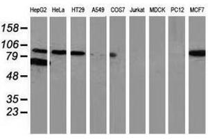Image no. 4 for anti-Catenin (Cadherin-Associated Protein), beta 1, 88kDa (CTNNB1) antibody (ABIN1496894)