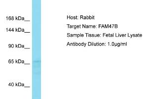 Host: Rabbit Target Name: FAM47B Sample Type: Fetal Liver lysates Antibody Dilution: 1.