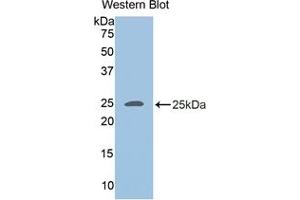 Detection of Recombinant ADRP, Human using Polyclonal Antibody to Adipose Differentiation Related Protein (ADRP) (ADRP anticorps  (AA 245-433))