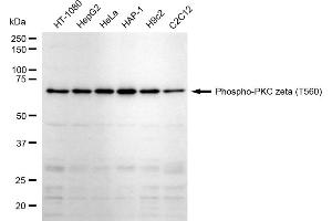 Western blotting analysis using Phospho-PKC zeta (T560) antibody (ABIN7800001).