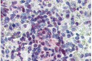 Human Spleen: Formalin-Fixed, Paraffin-Embedded (FFPE)