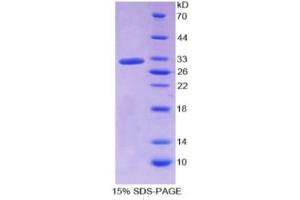 SDS-PAGE of Protein Standard from the Kit  (Highly purified E. (HPR Kit ELISA)