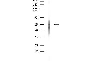 anti-Cholinergic Receptor, Nicotinic, alpha 7 (Neuronal) (CHRNA7) (N-Term) antibody