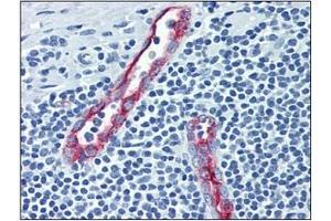 Immunohistochemistry (IHC) image for anti-Selectin P (Granule Membrane Protein 140kDa, Antigen CD62) (SELP) antibody (ABIN316863) (P-Selectin anticorps)