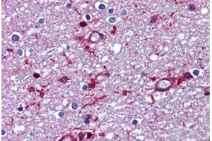 Human Brain, Cortex, White Matter: Formalin-Fixed, Paraffin-Embedded (FFPE)