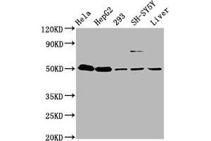Western Blot Positive WB detected in: Hela whole cell lysate, HepG2 whole cell lysate, 293 whole cell lysate, SH-SY5Y whole cell lysate, Mouse liver tissue All lanes: DYM antibody at 3. (Dymeclin anticorps  (AA 224-348))