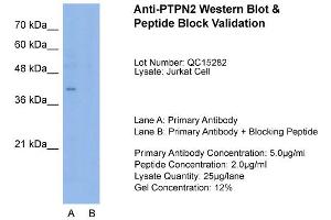 Host:  Rabbit  Target Name:  PTPN2  Sample Type:  Jurkat  Lane A:  Primary Antibody  Lane B:  Primary Antibody + Blocking Peptide  Primary Antibody Concentration:  5. (PTPN2 anticorps  (N-Term))
