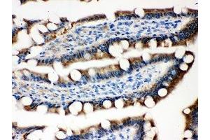 IHC-P testing of rat intestine tissue
