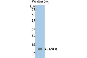 Western blot analysis of the recombinant protein. (S100 Protein (S100) (AA 2-94) anticorps)