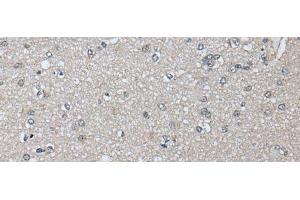 Immunohistochemistry of paraffin-embedded Human brain tissue using PRAME Polyclonal Antibody at dilution of 1:65(x200) (PRAME anticorps)