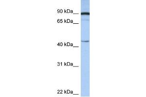 Human Brain; WB Suggested Anti-PSMD6 Antibody Titration: 0. (PSMD6 anticorps  (N-Term))