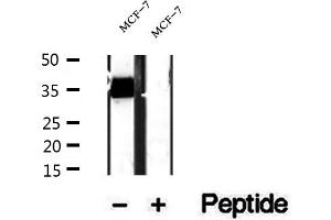 Western blot analysis of extracts of MCF-7 cells, using RQCD1 antibody. (RQCD1 anticorps  (Internal Region))