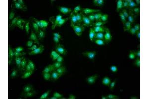 Immunofluorescence staining of HepG2 cells with ABIN7145619 at 1:166, counter-stained with DAPI. (FHIT anticorps  (AA 2-147))