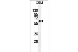 Western blot analysis in CEM cell line lysates (35ug/lane). (DOK3 anticorps  (C-Term))