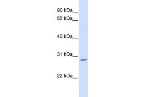 WB Suggested Anti-AEBP2 Antibody Titration: 0. (AEBP2 anticorps  (C-Term))