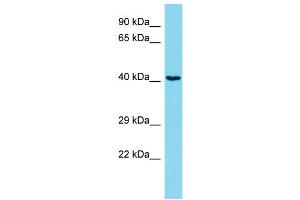 Host: Rabbit Target Name: ARHGEF39 Sample Type: Jurkat Whole Cell lysates Antibody Dilution: 1. (C9orf100 anticorps  (C-Term))
