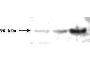 Image no. 1 for anti-PMS2 Postmeiotic Segregation Increased 2 (S. Cerevisiae) (PMS2) (AA 58-81) antibody (ABIN296611) (PMS2 anticorps  (AA 58-81))