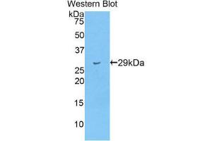 Western Blotting (WB) image for anti-Titin (TTN) (AA 33779-34025) antibody (ABIN1860878)