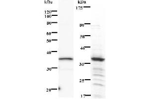 Left: PHF1 staining. (PHF1 anticorps)