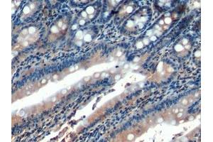 Detection of HCAM in Rat Small intestine Tissue using Polyclonal Antibody to Homing Associated Cell Adhesion Molecule (HCAM) (HCAM (AA 24-182) anticorps)
