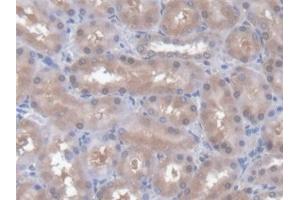 Detection of CD7 in Rat Kidney Tissue using Polyclonal Antibody to Cluster Of Differentiation 7 (CD7) (CD7 anticorps  (AA 23-128))