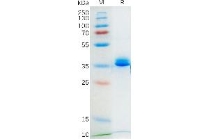 Mouse GD Protein, hFc Tag on SDS-PAGE under reducing condition.