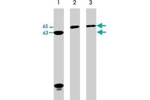 Western blot analysis of Jurkat (lane 1), A-431 (lane 2), and HeLa (lane 3) cell lysates (20 ug/lane). (Neural Wiskott-Aldrich syndrome protein (WASL) (C-Term) anticorps)