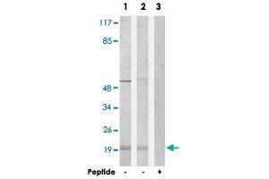 Western blot analysis of extracts from Jurkat cells (Lane 1) and COLO 205 cells (Lane 2 and lane 3), using PPP1R14C polyclonal antibody .