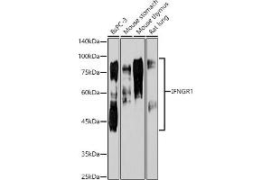 Western blot analysis of extracts of various cell lines, using IFNGR1 antibody  at 1:1000 dilution. (IFNGR1 anticorps)