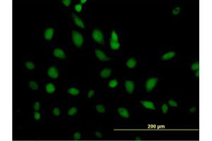 Immunofluorescence of purified MaxPab antibody to ERCC2 on HeLa cell. (ERCC2 anticorps  (AA 1-760))