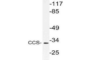 Western blot (WB) analysis of CCS antibody in extracts from Jurkat cells. (Superoxide dismutase copper chaperone anticorps)