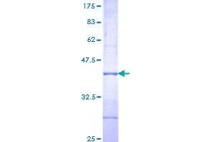 Image no. 1 for Interleukin 1 Receptor-Like 2 (IL1RL2) (AA 20-118) protein (GST tag) (ABIN1307763)