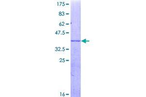 Image no. 1 for Cytochrome P450, Family 3, Subfamily A, Polypeptide 4 (CYP3A4) (AA 404-503) protein (GST tag) (ABIN1350990)