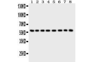 Anti- P2X2 Picoband antibody, Western blotting All lanes: Anti P2X2  at 0. (P2RX2 anticorps  (AA 139-471))