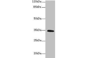 Western blot All lanes: SETD9 antibody at 6 μg/mL + K562 whole cell lysate Secondary Goat polyclonal to rabbit IgG at 1/10000 dilution Predicted band size: 35, 31 kDa Observed band size: 35 kDa (C5orf35 anticorps  (AA 1-299))