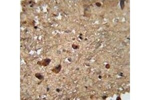 RAN antibody immunohistochemistry analysis in formalin fixed and paraffin embedded human brain tissue.