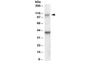 Western blot testing of rat brain lysate with GRIK3 antibody at 0. (GRIK3 anticorps)