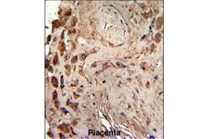 Formalin-fixed and paraffin-embedded human placenta reacted with PRKRA Antibody , which was peroxidase-conjugated to the secondary antibody, followed by DAB staining.