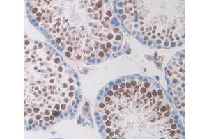 Used in DAB staining on fromalin fixed paraffin- embedded testis tissue