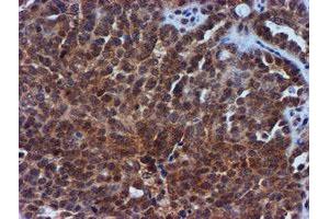 Image no. 7 for anti-Metalloproteinase Inhibitor 2 (TIMP2) antibody (ABIN1501393) (TIMP2 anticorps)