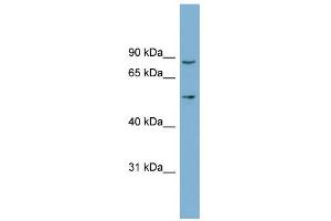WB Suggested Anti-LRDD Antibody Titration: 0. (PIDD anticorps  (Middle Region))