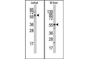 Image no. 1 for anti-K(lysine) Acetyltransferase 5 (KAT5) (N-Term) antibody (ABIN356624) (KAT5 anticorps  (N-Term))