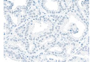 Immunohistochemistry (IHC) image for anti-Non-POU Domain Containing, Octamer-Binding (NONO) (AA 1-50) antibody (ABIN7453849) (NONO anticorps  (AA 1-50))