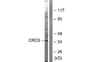 Western blot analysis of extracts from Hela cells treated with PMA (125ng/ml, 30min), using CREB (Ab-142) antibody (#B0006, Line 1 and 2). (CREB1 anticorps  (Ser142))