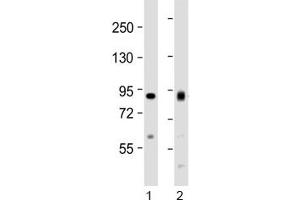 Western blot testing of human 1) HeLa and 2) Jurkat cell lysate with ACO2 antibody at 1:1000.